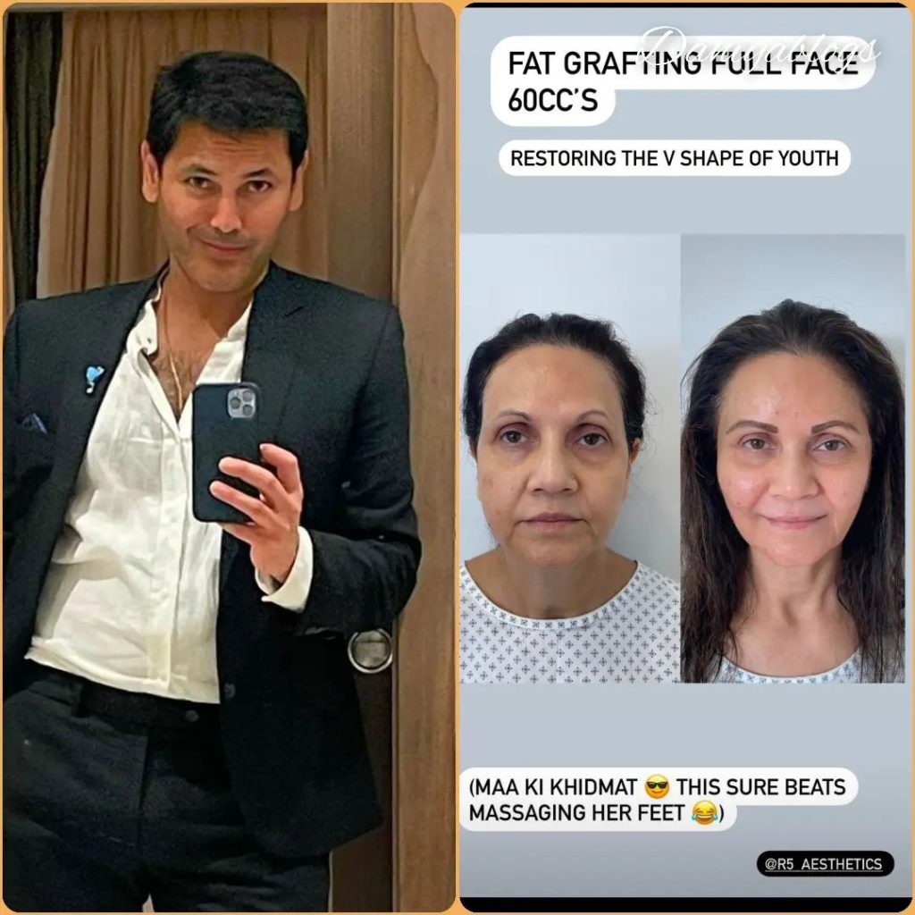 Actor Fahad Mirza Transformed Her mother after plastic surgery