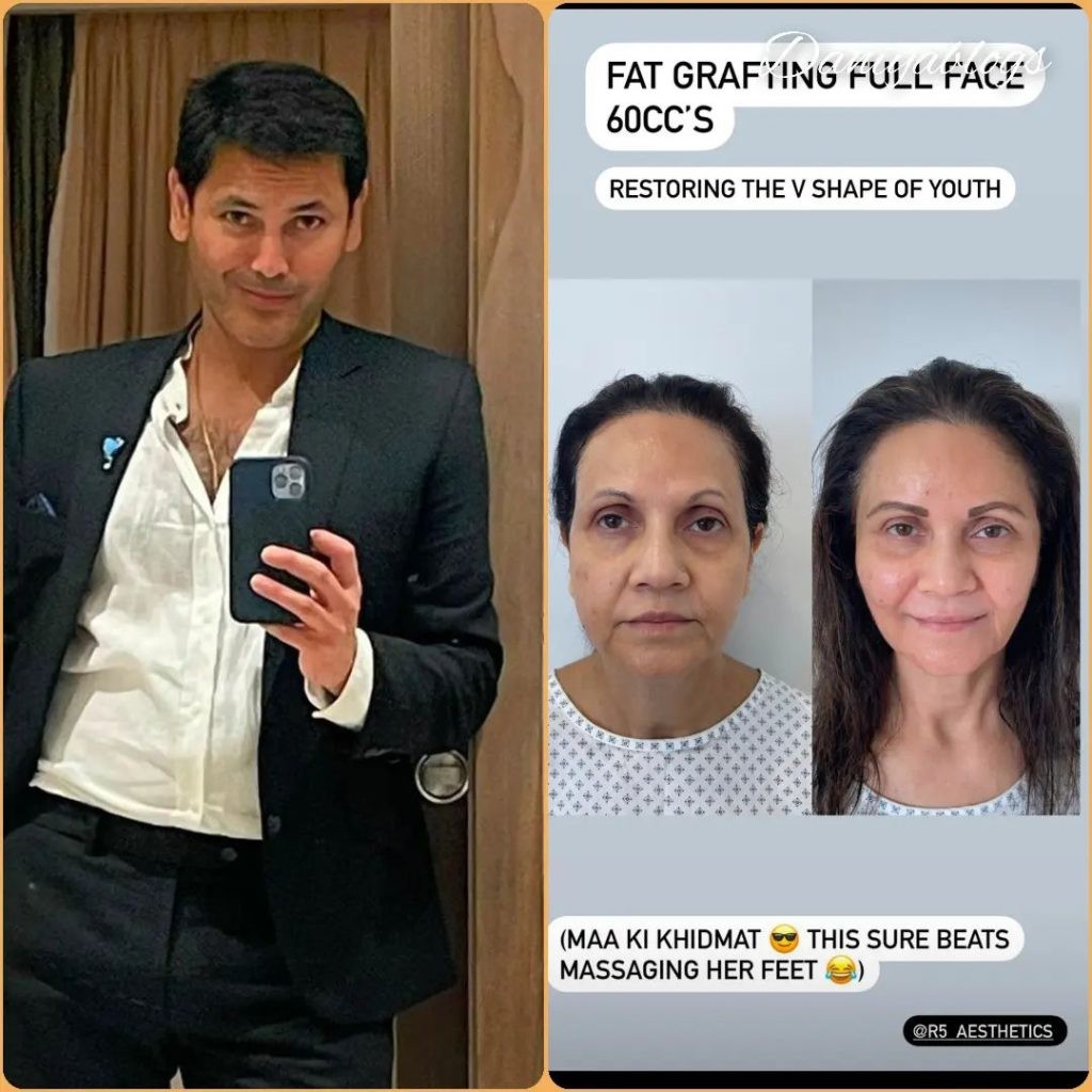 Actor Fahad Mirza Transformed Her mother after plastic surgery 2 Actor Fahad Mirza Transformed Her mother after plastic surgery